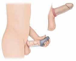 sex por penisringar sex por penisringar